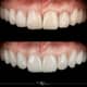 Slider image (10) Jimer Dental Clinics